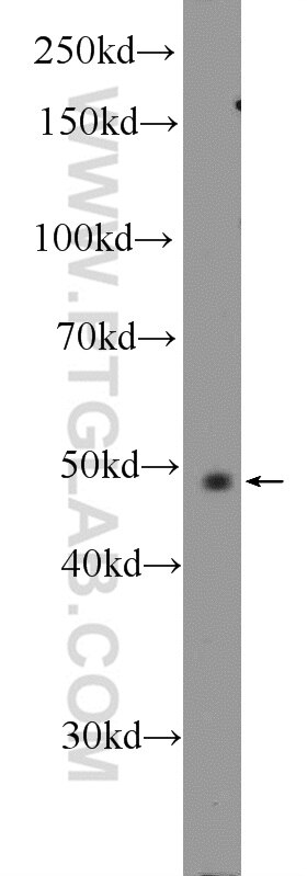 ERRa Polyclonal antibody