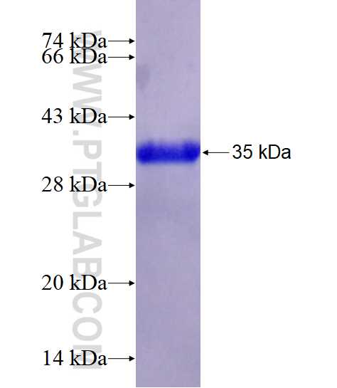 ERRa fusion protein Ag24631 SDS-PAGE