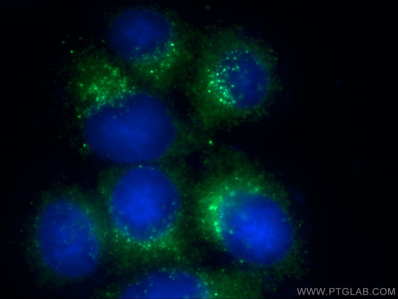 Immunofluorescence (IF) / fluorescent staining of HeLa cells using ERp72 Monoclonal antibody (66365-1-Ig)