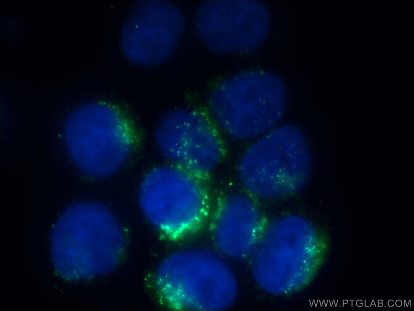 Immunofluorescence (IF) / fluorescent staining of HeLa cells using ERp72 Monoclonal antibody (66365-1-Ig)