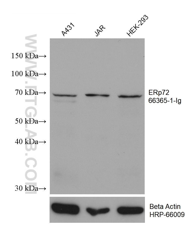 Western Blot (WB) analysis of various lysates using ERp72 Monoclonal antibody (66365-1-Ig)