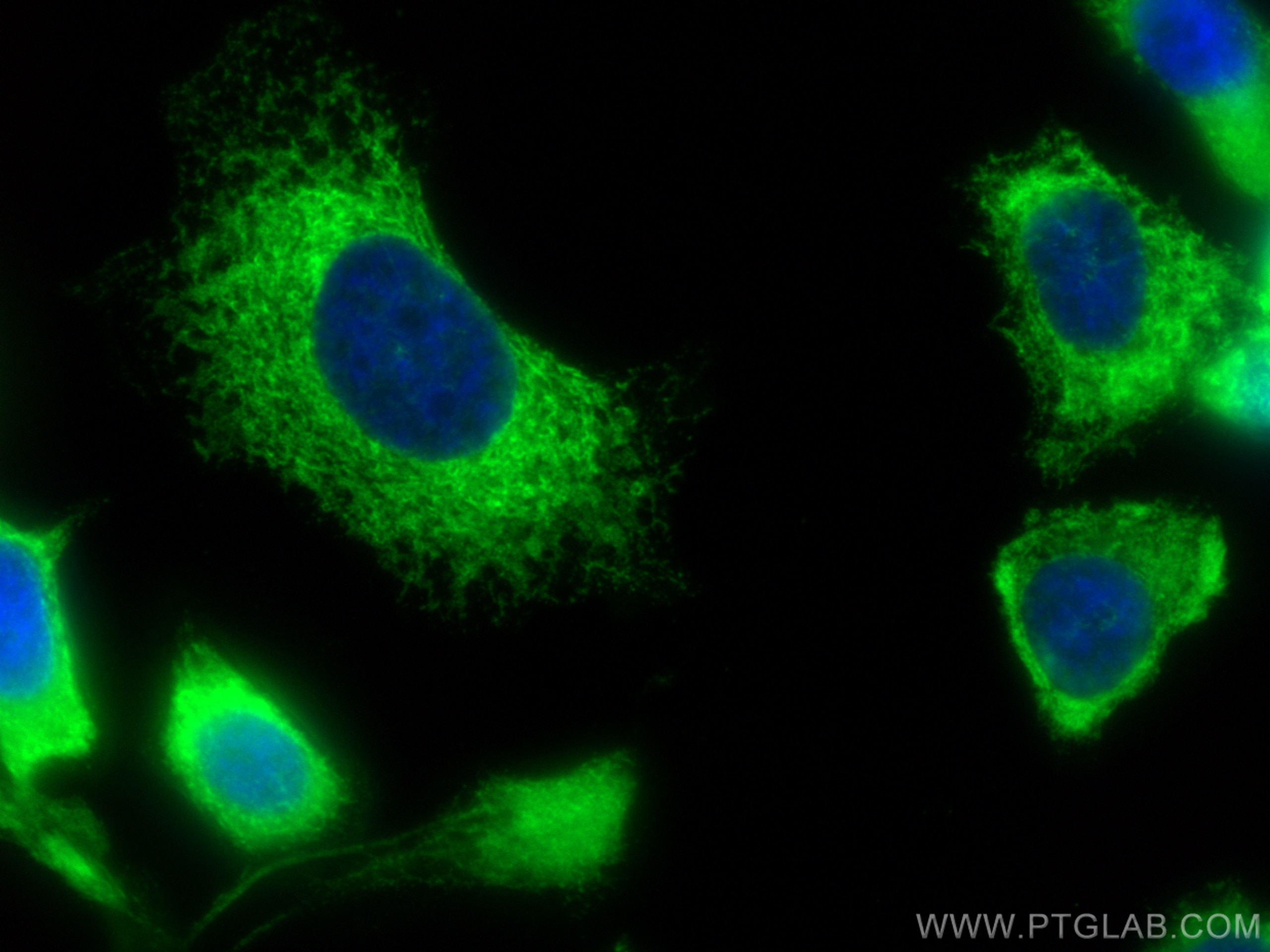 Immunofluorescence (IF) / fluorescent staining of PC-3 cells using CoraLite® Plus 488-conjugated ERp72 Polyclonal ant (CL488-14712)