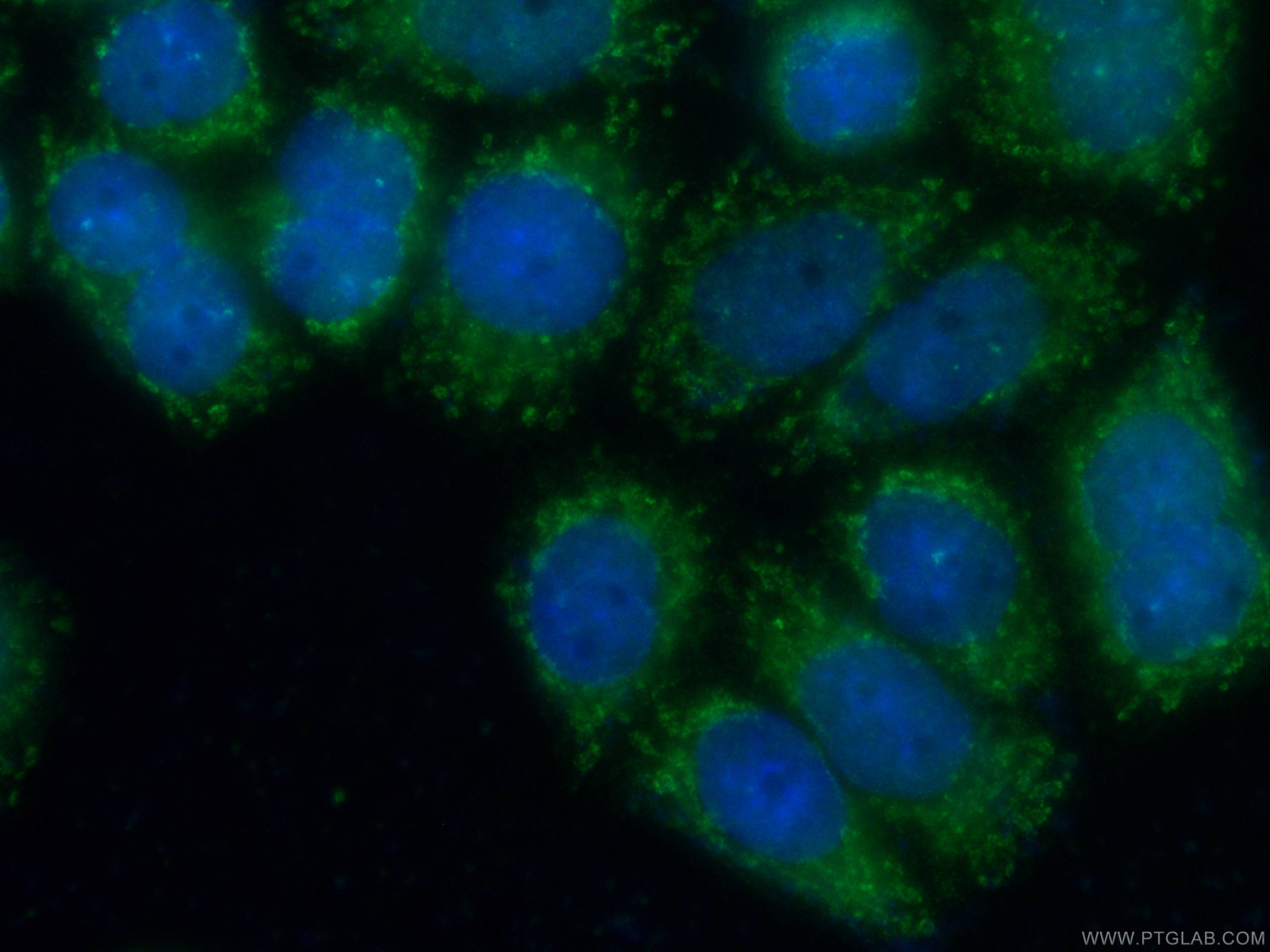 Immunofluorescence (IF) / fluorescent staining of HeLa cells using CoraLite® Plus 488-conjugated ERp72 Monoclonal ant (CL488-66365)