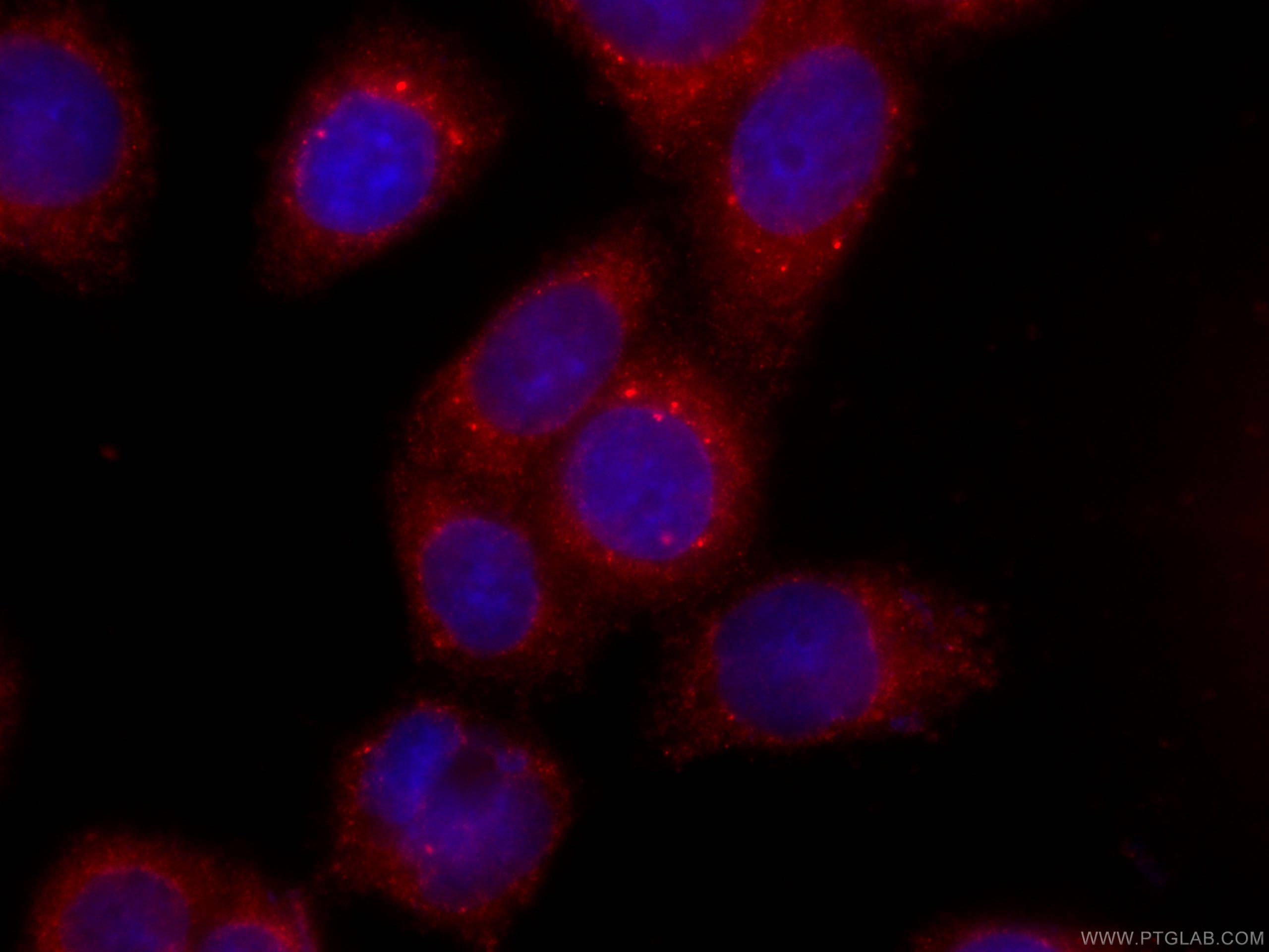 Immunofluorescence (IF) / fluorescent staining of HeLa cells using CoraLite®594-conjugated ERp72 Monoclonal antibody (CL594-66365)