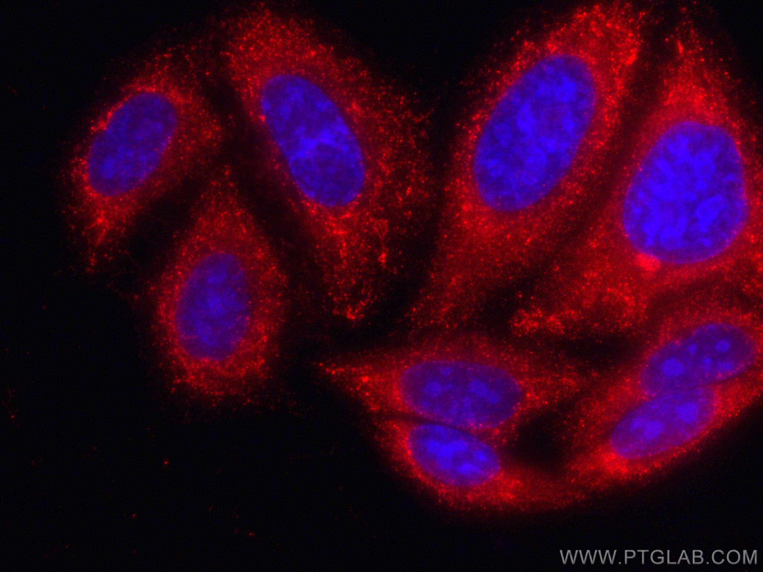 Immunofluorescence (IF) / fluorescent staining of HepG2 cells using CoraLite®594-conjugated ERp72 Monoclonal antibody (CL594-66365)