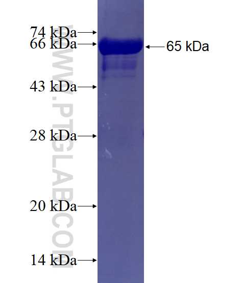 ERp72 fusion protein Ag6431 SDS-PAGE