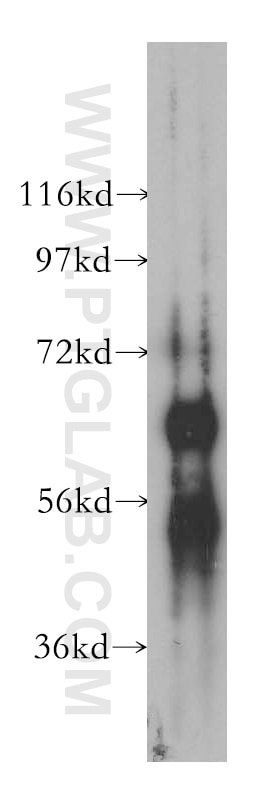 Western Blot (WB) analysis of human heart tissue using ESAM Polyclonal antibody (12445-1-AP)