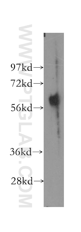 Western Blot (WB) analysis of human lung tissue using ESAM Polyclonal antibody (12445-1-AP)