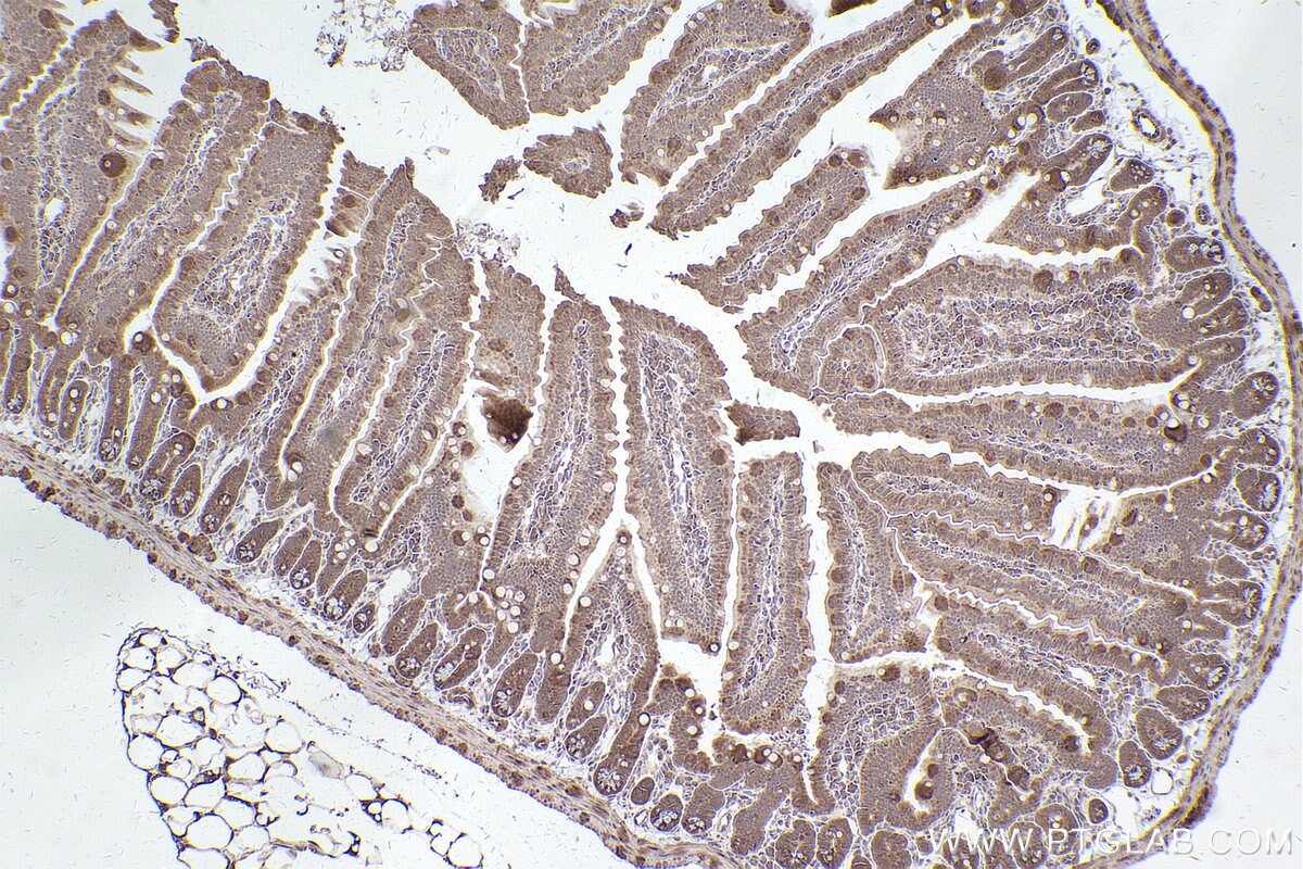 Immunohistochemistry (IHC) staining of mouse small intestine tissue using ESCO1 Polyclonal antibody (29821-1-AP)