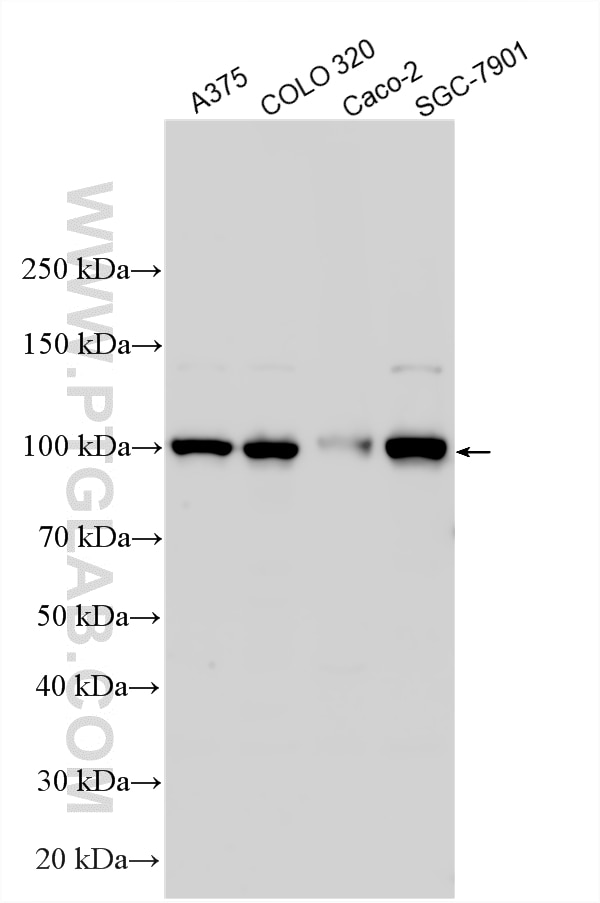 Western Blot (WB) analysis of various lysates using ESCO1 Polyclonal antibody (29821-1-AP)