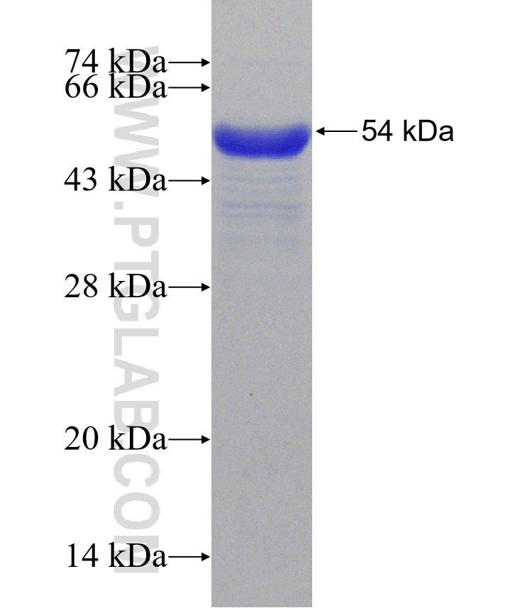 ESCO1 fusion protein Ag31189 SDS-PAGE