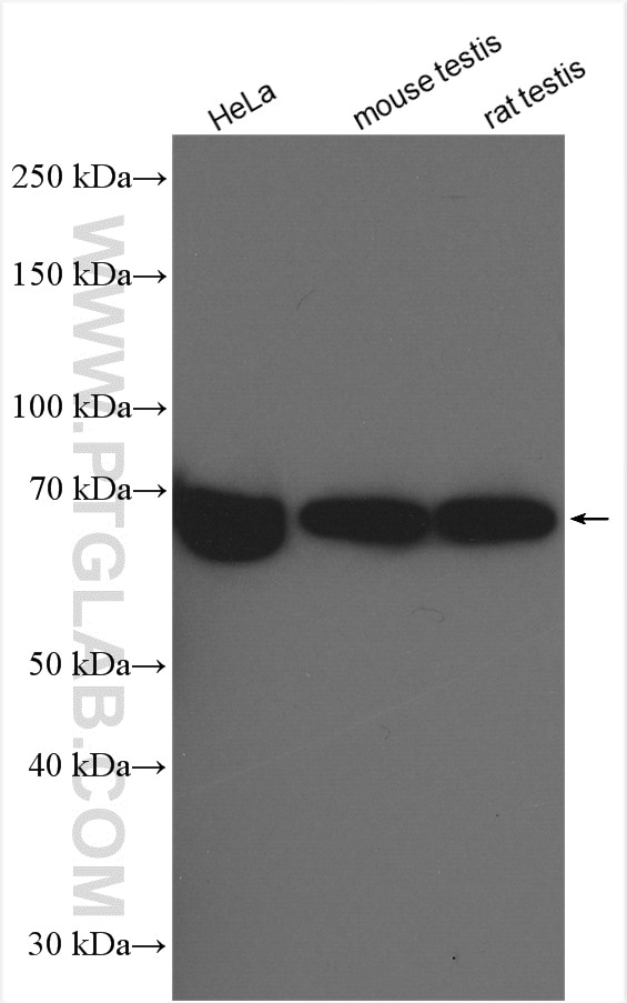 Western Blot (WB) analysis of various lysates using ESCO2 Polyclonal antibody (23525-1-AP)