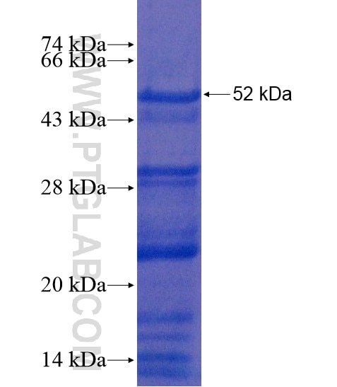 ESCO2 fusion protein Ag18893 SDS-PAGE