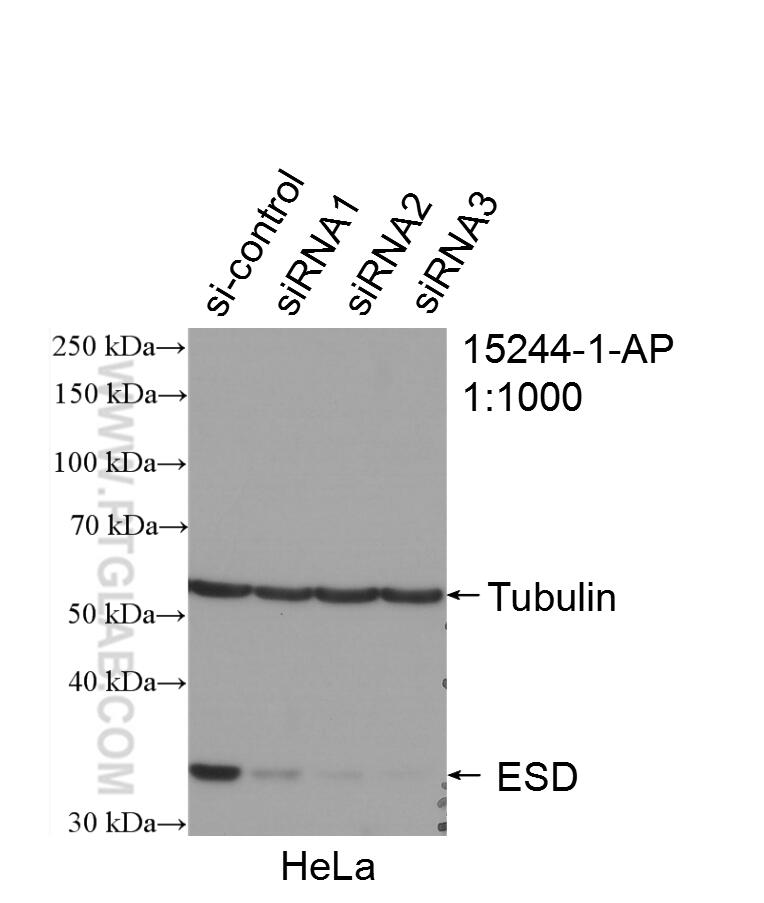 Western Blot (WB) analysis of HeLa cells using ESD Polyclonal antibody (15244-1-AP)