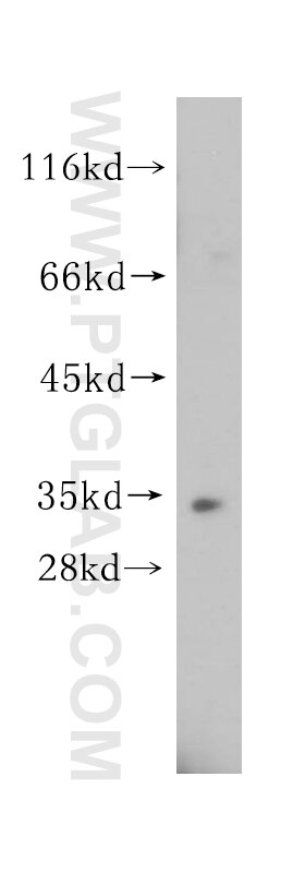 Western Blot (WB) analysis of HeLa cells using ESD Polyclonal antibody (15244-1-AP)