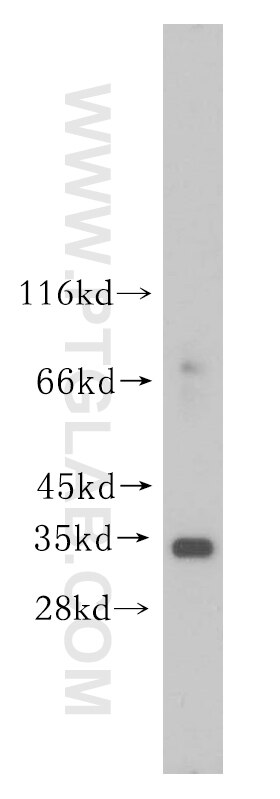 Western Blot (WB) analysis of K-562 cells using ESD Polyclonal antibody (15244-1-AP)