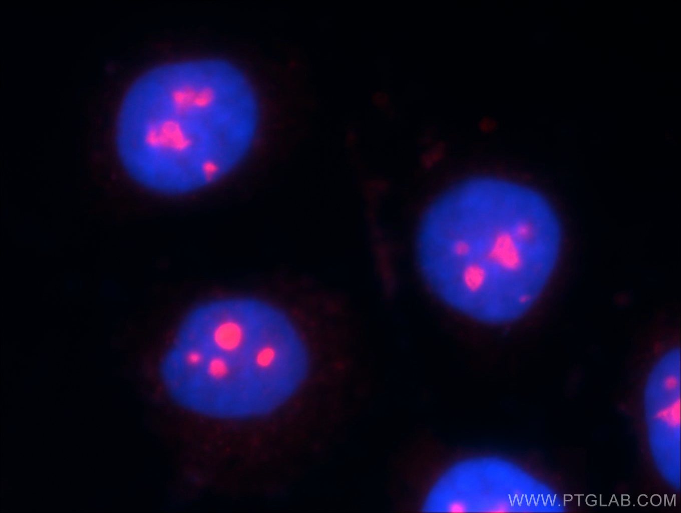 Immunofluorescence (IF) / fluorescent staining of MCF-7 cells using ESF1 Polyclonal antibody (23496-1-AP)