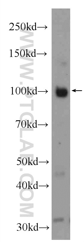 Western Blot (WB) analysis of mouse heart tissue using ESF1 Polyclonal antibody (23496-1-AP)