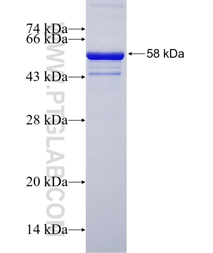 ESF1 fusion protein Ag19037 SDS-PAGE