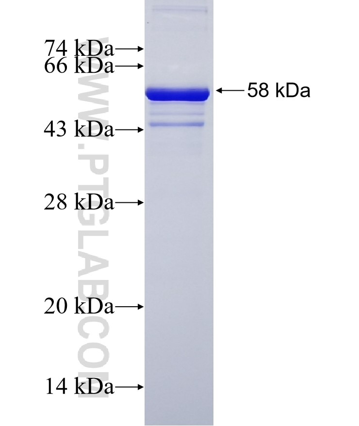 ESF1 fusion protein Ag19037 SDS-PAGE