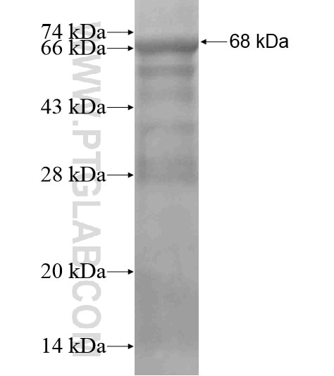 ESF1 fusion protein Ag19041 SDS-PAGE