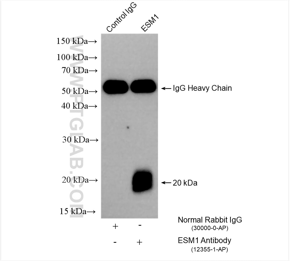Immunoprecipitation (IP) experiment of HUVEC cells using ESM1 Polyclonal antibody (12355-1-AP)
