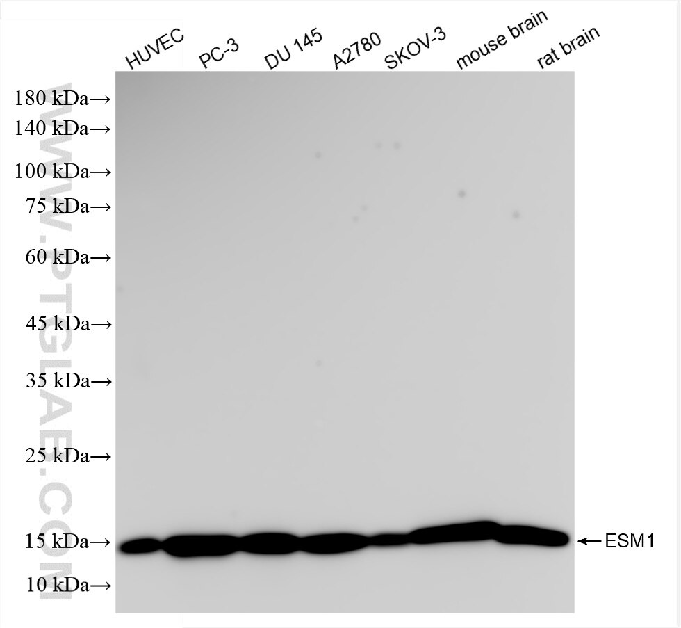 Western Blot (WB) analysis of various lysates using ESM1 Recombinant antibody (86027-1-RR)