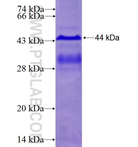 ESM1 fusion protein Ag3019 SDS-PAGE