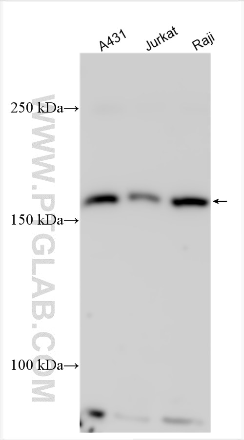 Western Blot (WB) analysis of various lysates using ESPL1 Polyclonal antibody (22261-1-AP)