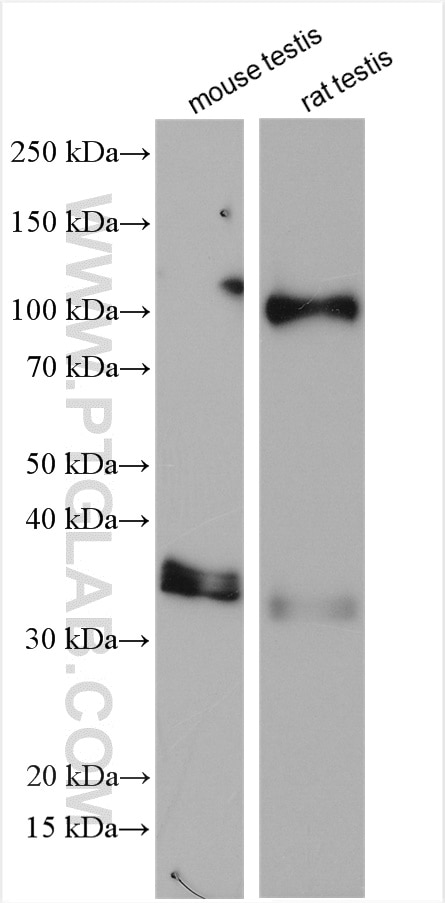 Western Blot (WB) analysis of various lysates using ESPN Polyclonal antibody (20717-1-AP)