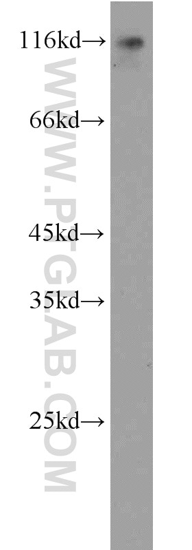 WB analysis of Neuro-2a using 20717-1-AP