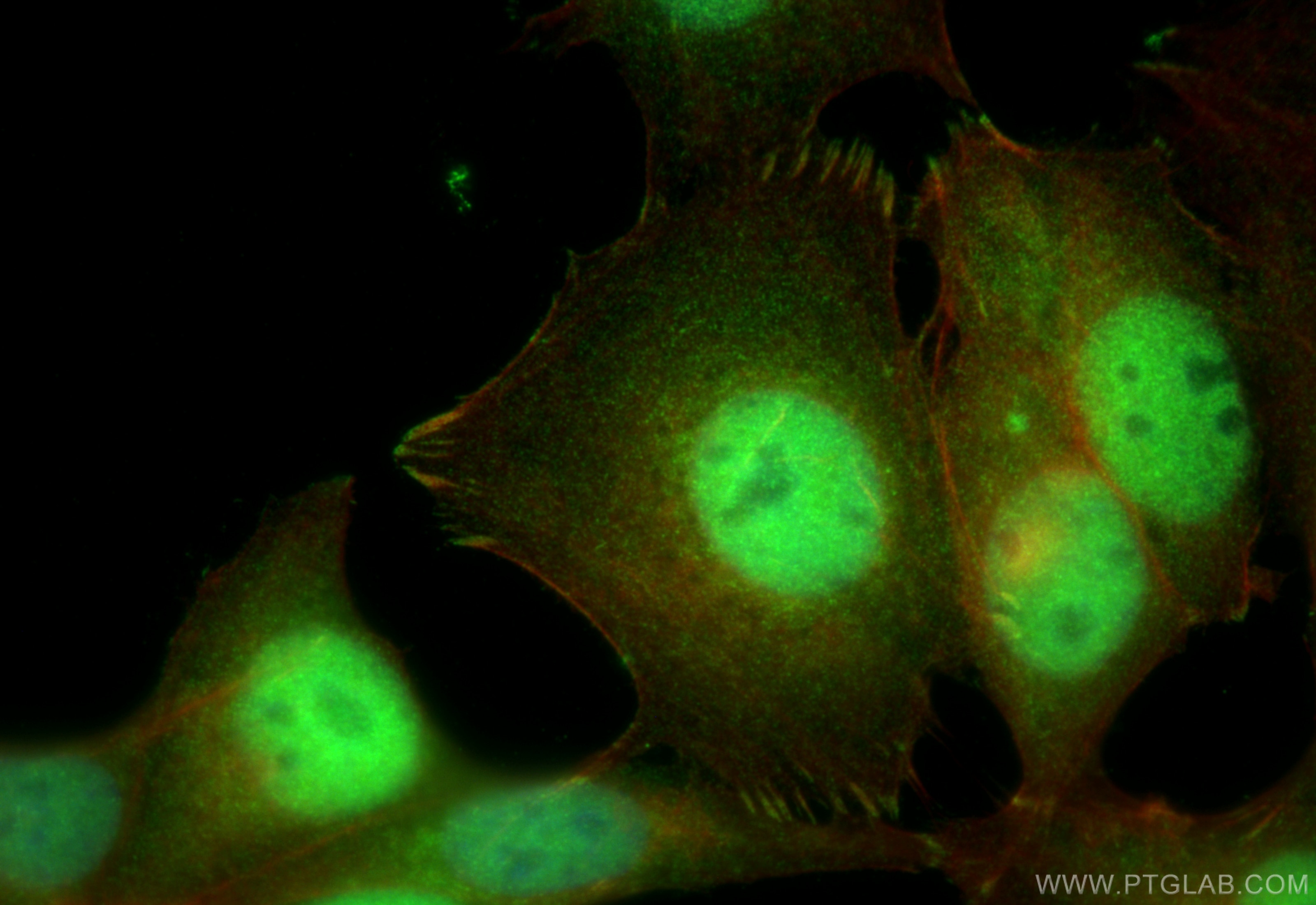 Immunofluorescent analysis of (4% PFA) fixed MCF-7 cells using ER antibody (21244-1-AP) at dilution of 1:400 and Multi-rAb CoraLite ® Plus 488-Goat Anti-Rabbit Recombinant Secondary Antibody (H+L) (RGAR002), CL594-Phalloidin (red). Immunofluorescence (IF) / fluorescent staining of MCF-7 cells using ER Polyclonal antibody (21244-1-AP)