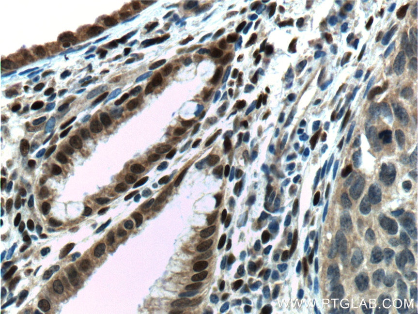 ER Polyclonal antibody