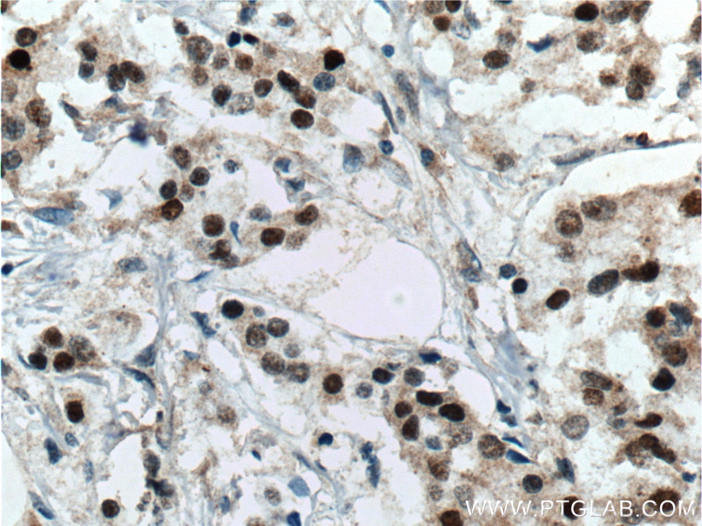 ER Polyclonal antibody