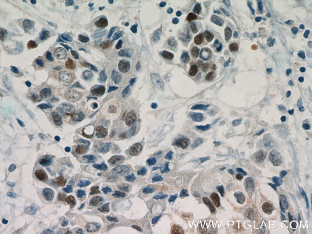 ER Polyclonal antibody