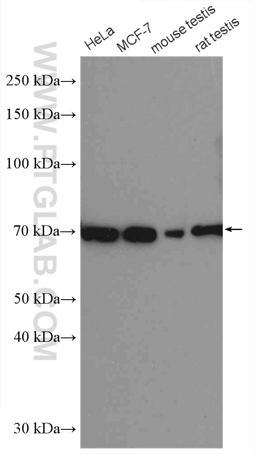 Western Blot (WB) analysis of various lysates using ER Polyclonal antibody (21244-1-AP)