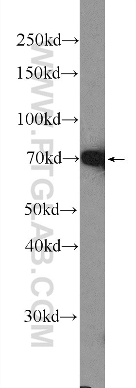 Western Blot (WB) analysis of mouse testis tissue using ER Polyclonal antibody (21244-1-AP)