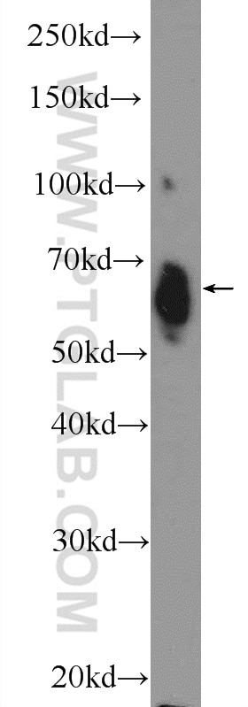 Western Blot (WB) analysis of NIH/3T3 cells using ER Polyclonal antibody (21244-1-AP)