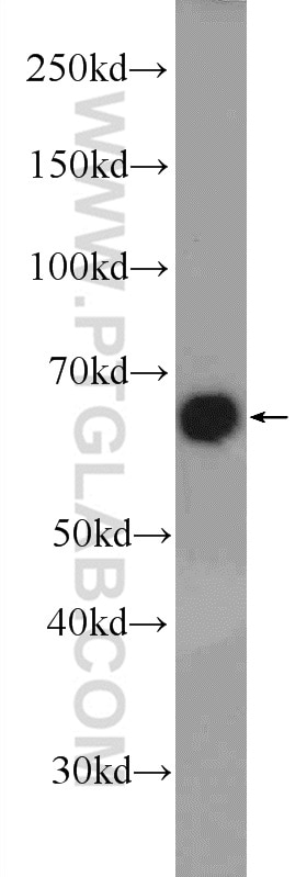 Western Blot (WB) analysis of HeLa cells using ER Polyclonal antibody (21244-1-AP)