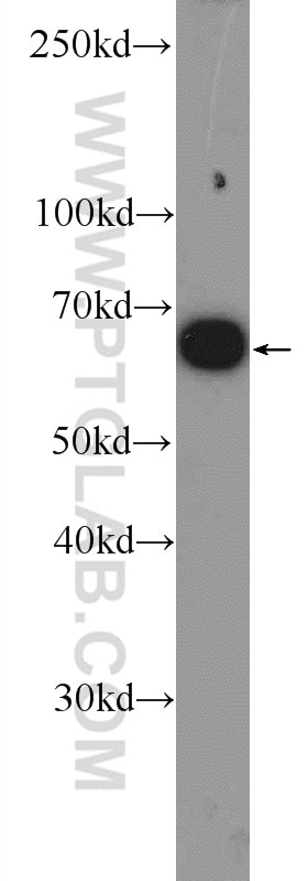 ER Polyclonal antibody