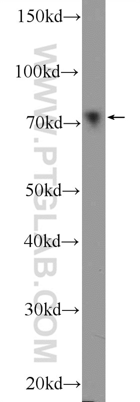 Western Blot (WB) analysis of rat testis tissue using ER Polyclonal antibody (21244-1-AP)