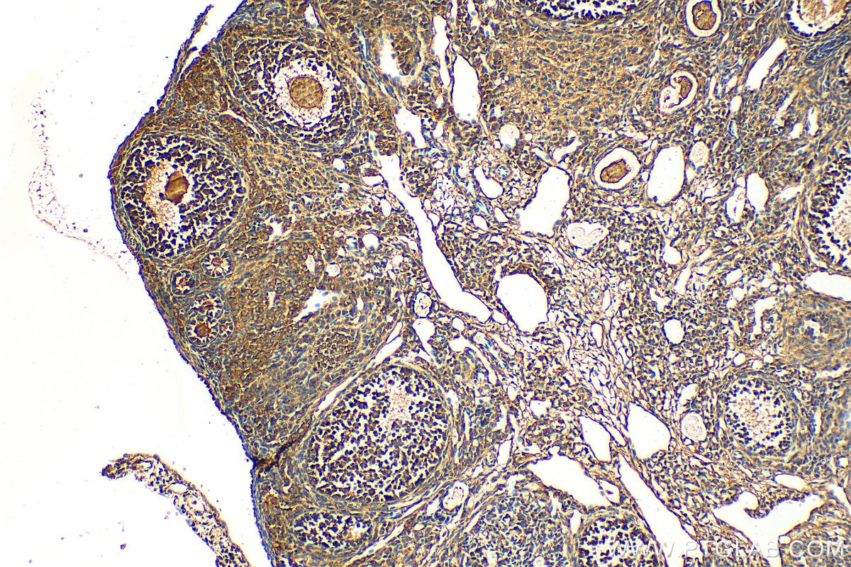 Immunohistochemistry (IHC) staining of mouse ovary tissue using ESR2 Polyclonal antibody (14007-1-AP)