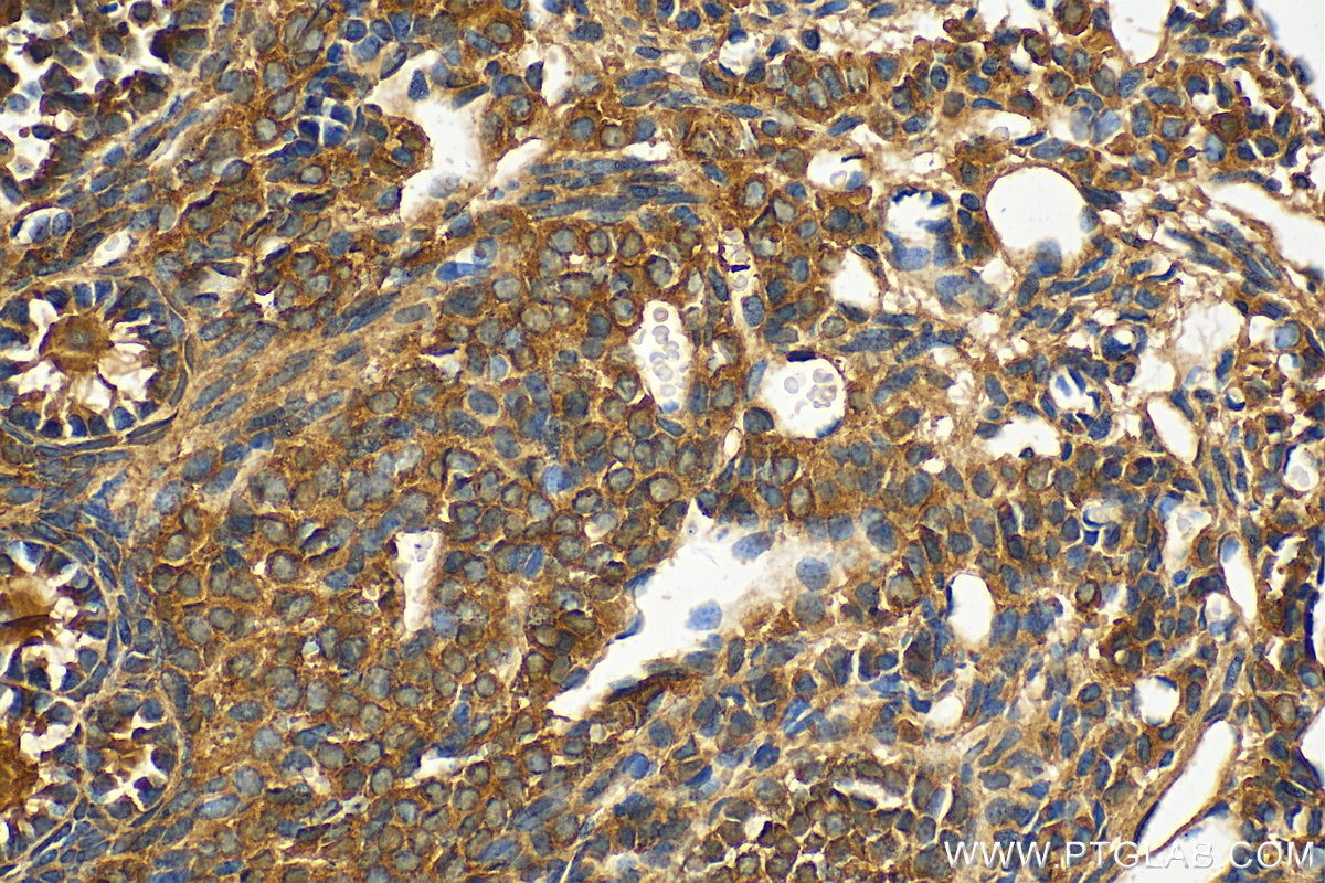 Immunohistochemistry (IHC) staining of mouse ovary tissue using ESR2 Polyclonal antibody (14007-1-AP)