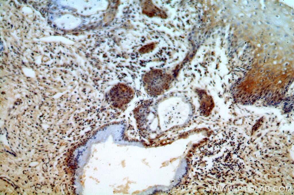 ESR2 Polyclonal antibody