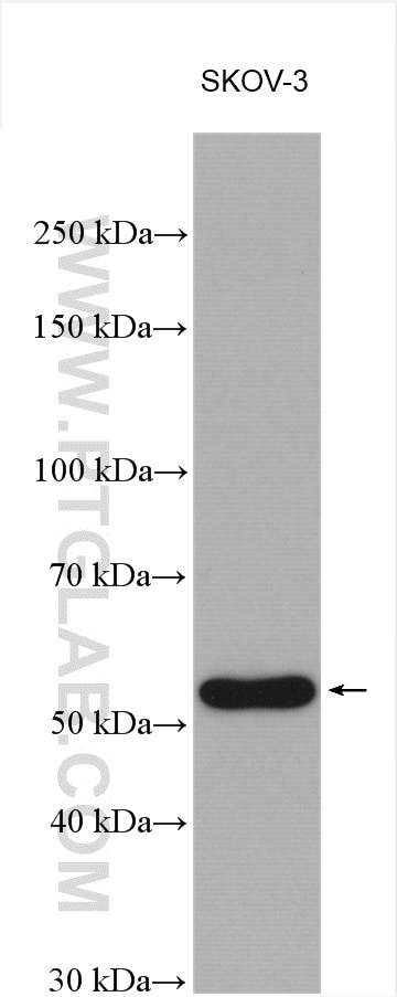 Western Blot (WB) analysis of various lysates using ESR2 Polyclonal antibody (14007-1-AP)