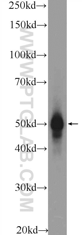 Western Blot (WB) analysis of mouse brain tissue using ESR2 Polyclonal antibody (14007-1-AP)