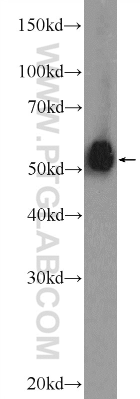ESR2 Polyclonal antibody