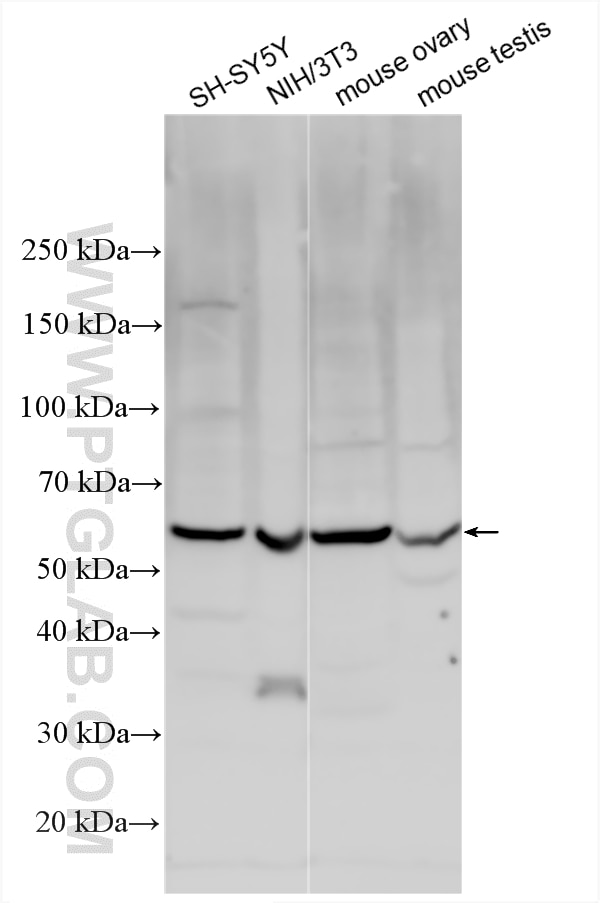 Western Blot (WB) analysis of various lysates using ESR2 Polyclonal antibody (14007-1-AP)