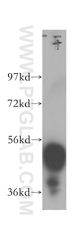 Western Blot (WB) analysis of mouse testis tissue using ESR2 Polyclonal antibody (14007-1-AP)