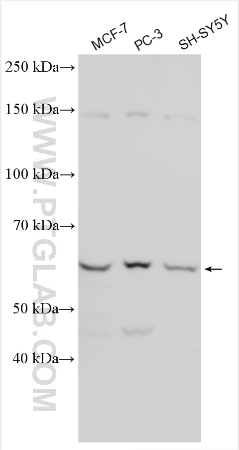 Western Blot (WB) analysis of various lysates using ESR2 Polyclonal antibody (30694-1-AP)